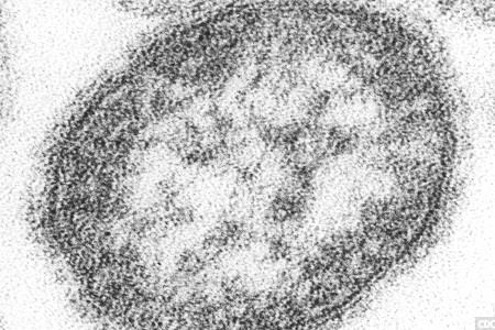 Action urged after half a million children miss measles vaccination