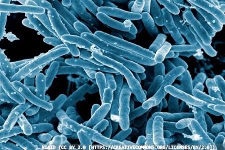 International tuberculosis symposium: a two-day event in London    