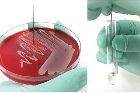 Sample inoculum  preparation: a UK ring  trial of the Inoclic device