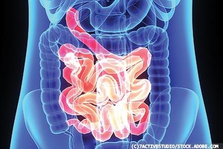Coeliac disease: diet,  diagnosis, dermatitis  and refractory disease