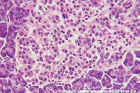 Role of fructosamine in diabetes: enabling tighter glycaemic control