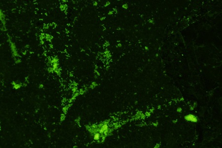 Monoclonal antibodies to mycobacteria