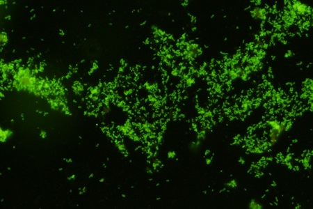 Monoclonal antibodies to Gardnerella 