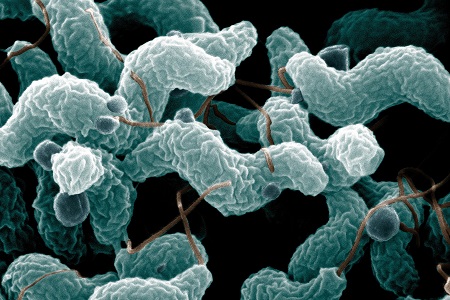 Challenges of culturing Campylobacter species