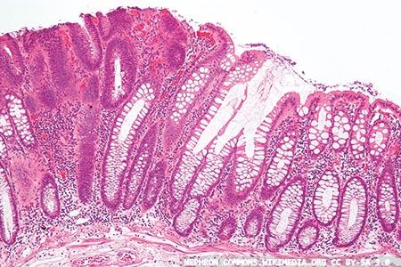 Faecal haemoglobin  concentration estimates:  how low can FIT go?