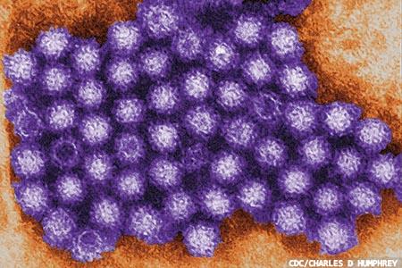 Human norovirus:  a brief look at research  in the current literature