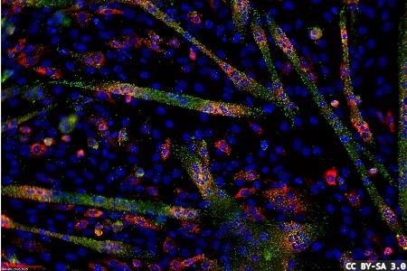 Molecular and cytogenomics data generation and interpretation
