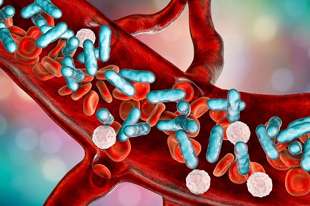 Haematology partnership aims to reduce the impact of sepsis in the UK