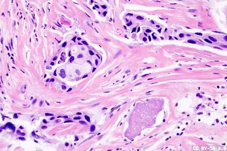 Faster, more accurate and efficient automated tissue dissection