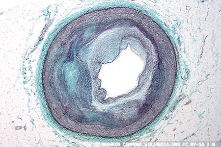 Cardiac biomarkers: from harmonisation to hormones over the past decade