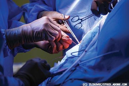Surgical site infections: a need to galvanise efforts to reduce occurrence