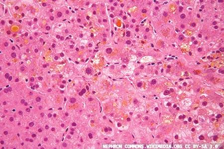 Total bile acids testing: fifth-generation method in cholestasis of pregnancy