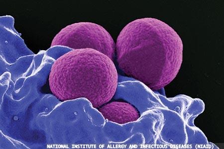 Antimicrobial efficacy and lack of resistance to silane quaternary com