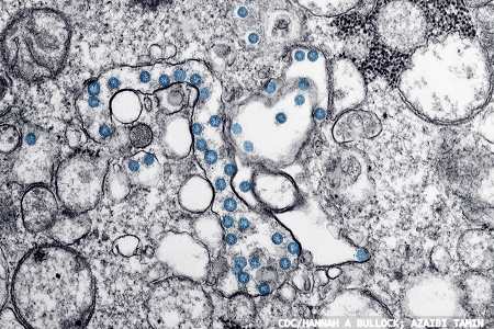 SiQuats destroy the SARS-CoV-2 coronavirus: reporting research results