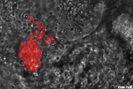 Malaria mosquito research: insect control update