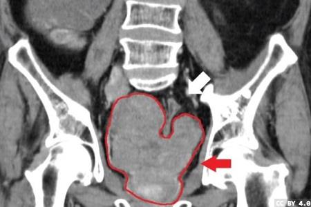 Strategic alliance provides automated workflows for prostate cancer diagnostics