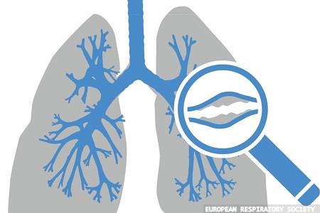 Gap between non-tuberculous mycobacteria testing behaviour and guidelines identified