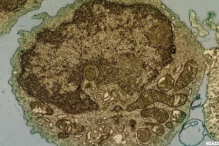 SARS-CoV-2 coronavirus: rabbit antibody discovery using single B-cell screening