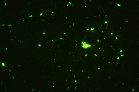 Monoclonal antibodies to clostridia glutamate dehydrogenase