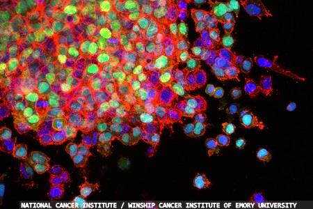 Improving early diagnosis in cancer, thoracic and liver disease