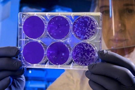 Point-of-care virus testing using screen-printed electrodes