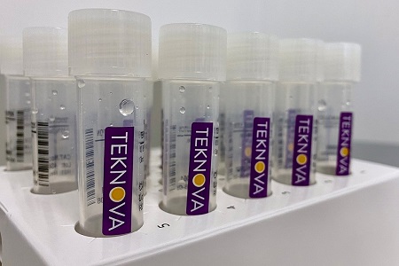 Viral transport media production scaled up in response to SARS-CoV-2 