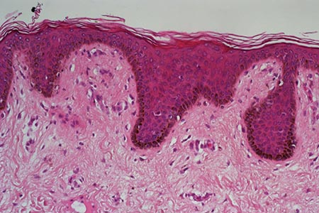 New haematoxylin for  routine diagnostic use:  a comparative study