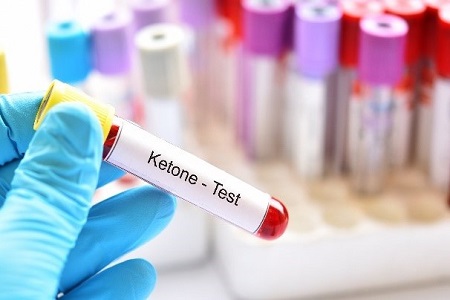 Overcoming the current challenges in ketone testing