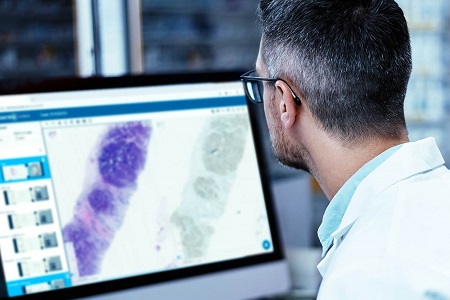 Addressing the critical challenge of cancer overdiagnosis 