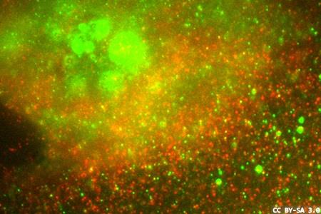 Rare genetic mutation: a driver of multiple tumour malignancies