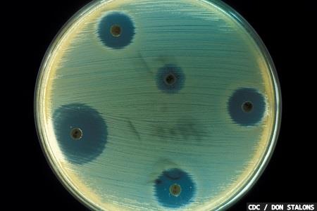 Surveillance of AMR diseases could be more challenging outside the EU