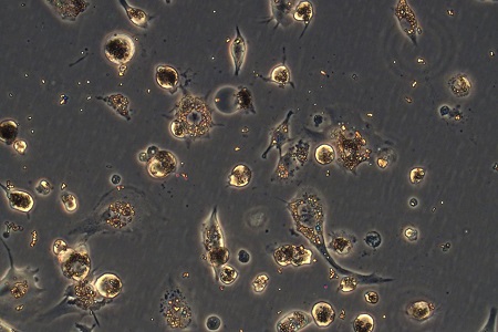 Nanoparticle cytokines enable use of macrophages to treat disease