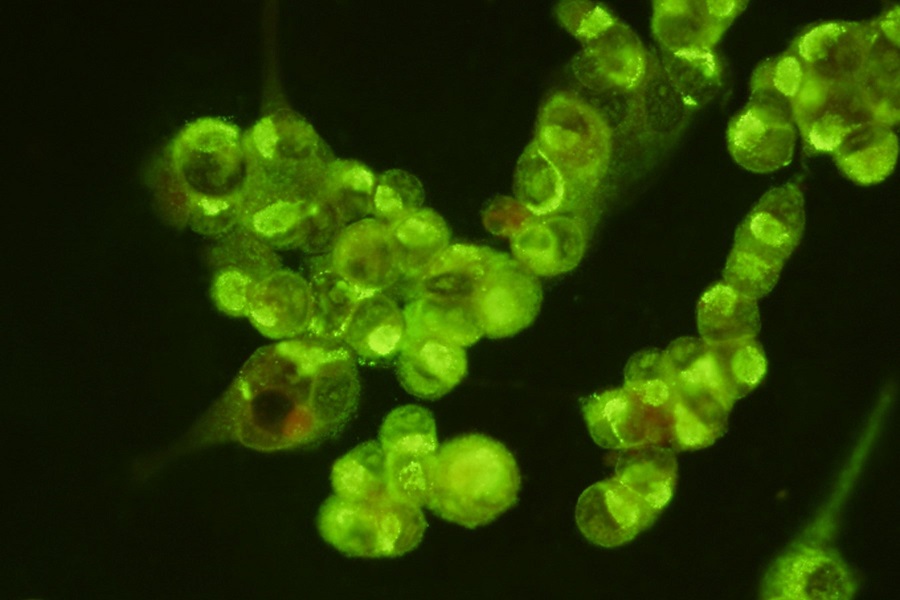 Antigen detection of SARS-CoV-2 variants