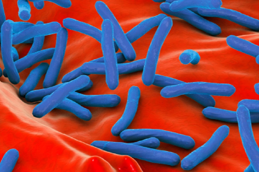 The latest aid in the diagnosis of tuberculosis