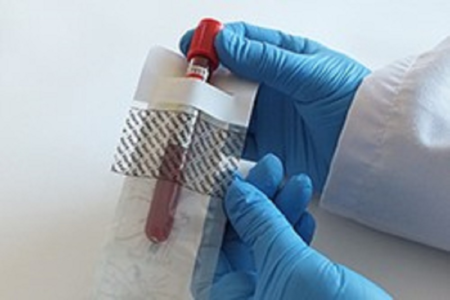 Cost-effective and user-friendly specimen bio-pouch