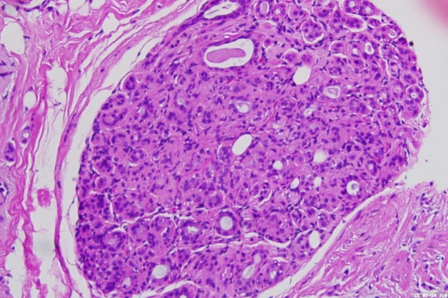 CE mark for AI-powered breast cancer detection