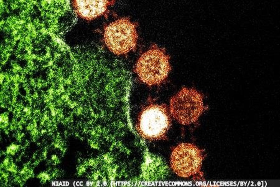 SARS-CoV-2 antigen lateral-flow test detects Delta variant