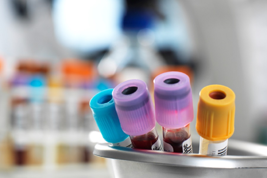 Mandated funding needed to boost access to diagnostic innovations 