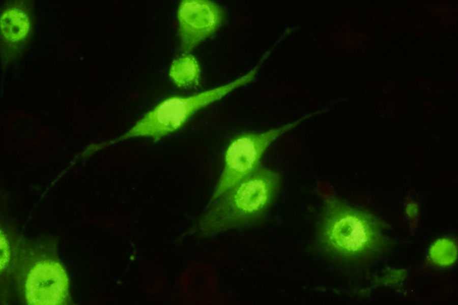 Antibodies to canine parvovirus