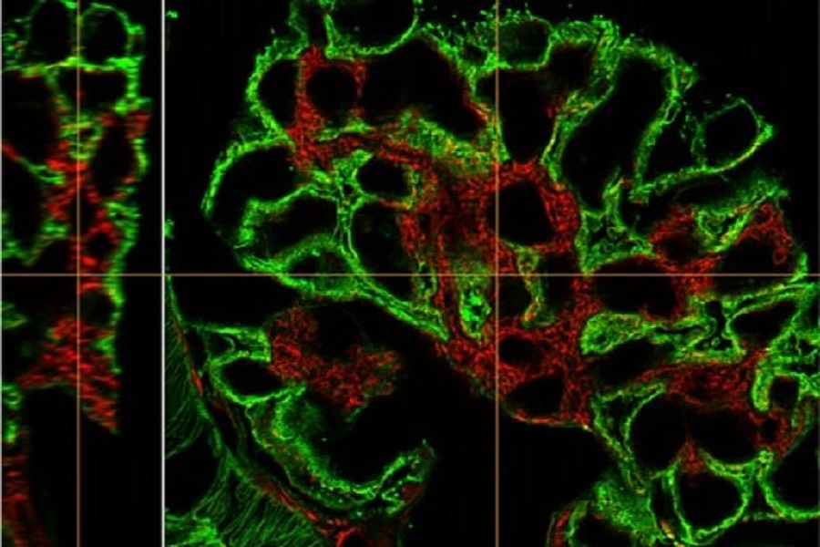 Super-resolution confocal microscope module launched