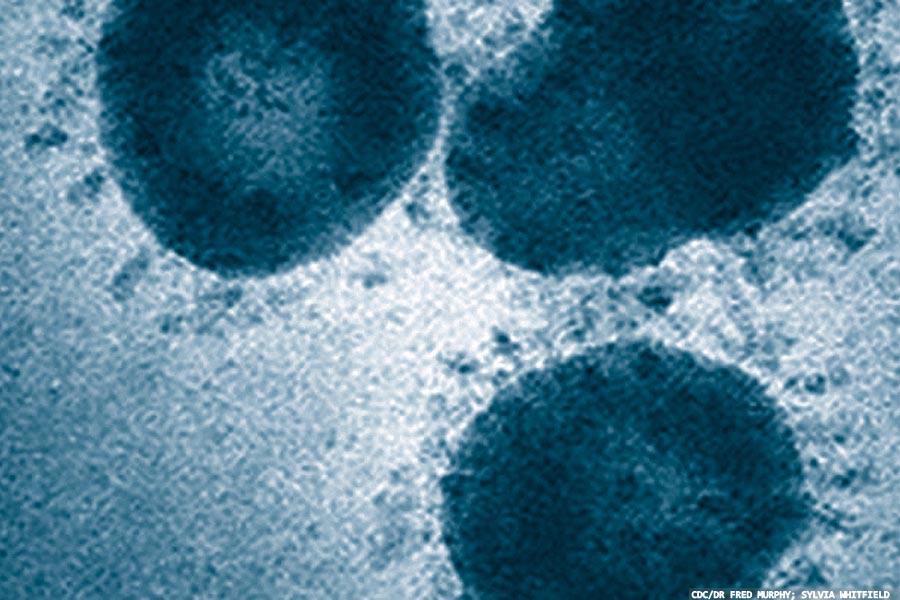 Loop-mediated isothermal amplification: from brucellosis to SARS-CoV-2