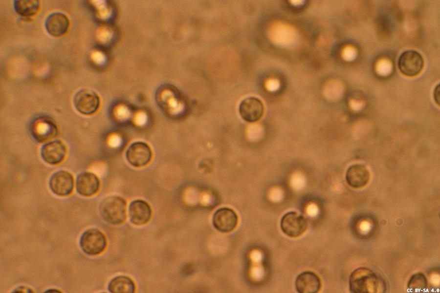 Improved prescribing of antibiotics for bacterial infections 