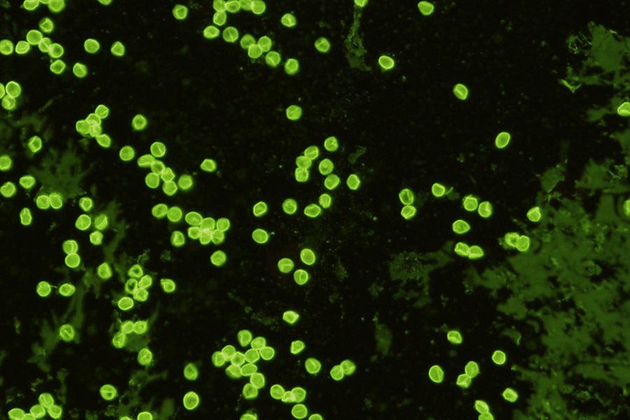 Monoclonal antibodies to Cryptosporidium parvum