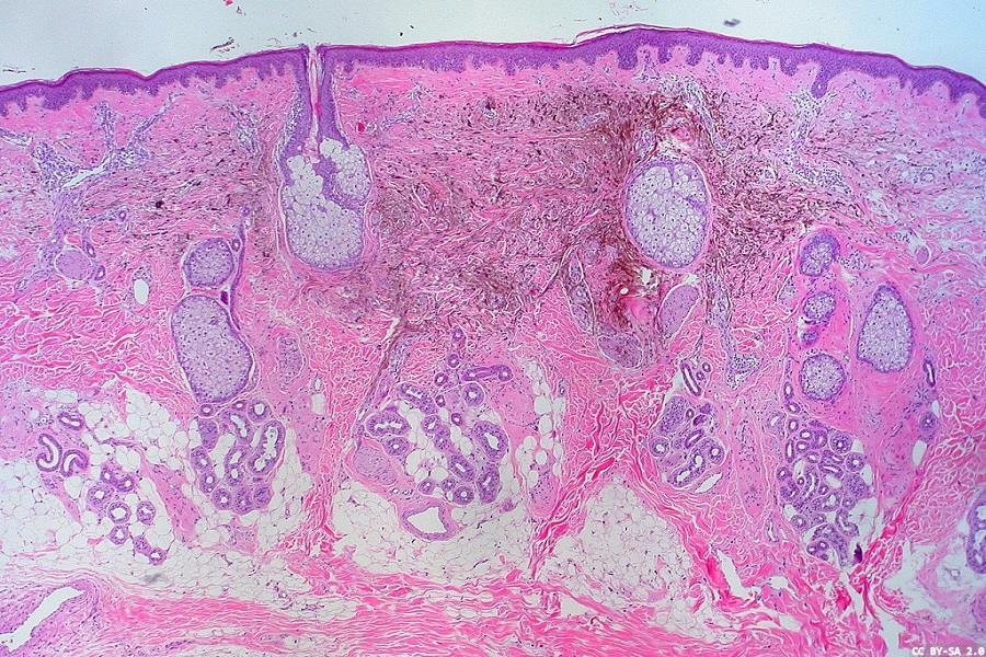 Advancing AI-driven skincare research and diagnostics
