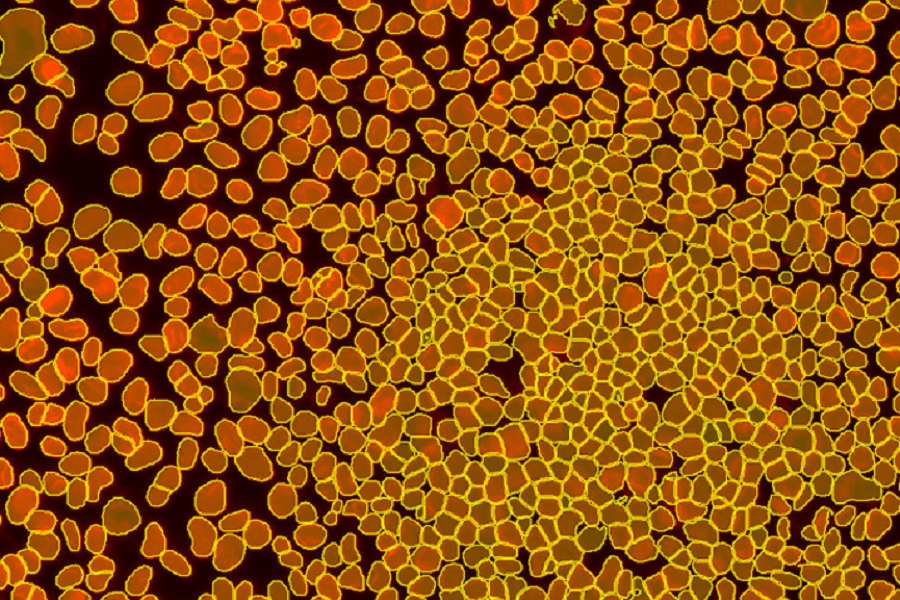 Improved deep-learning capabilities for fast, efficient image analysis