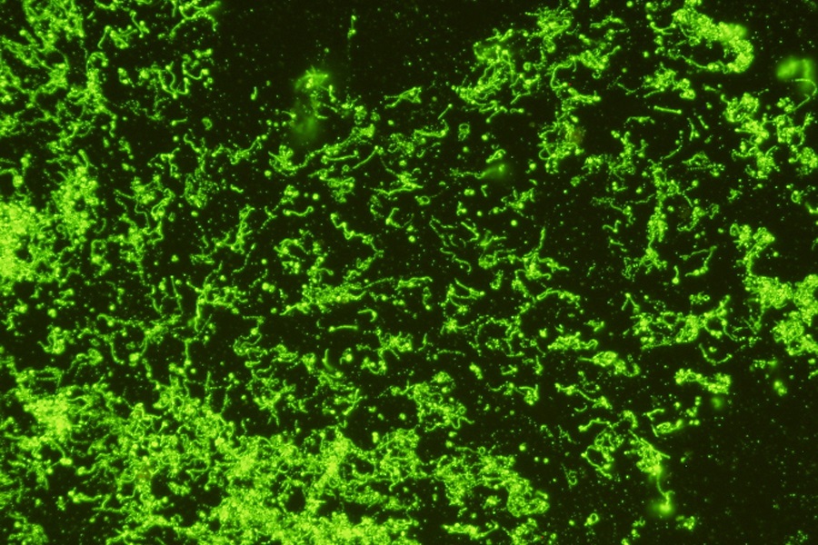 Monoclonal antibodies to pathogenic Leptospira 