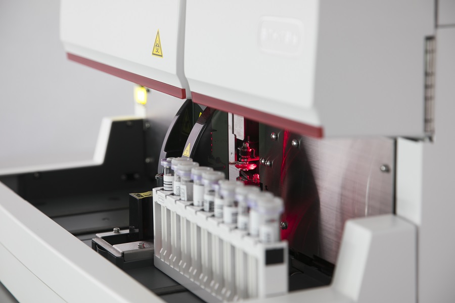 Two high-speed HbA1c analysers launched in the UK