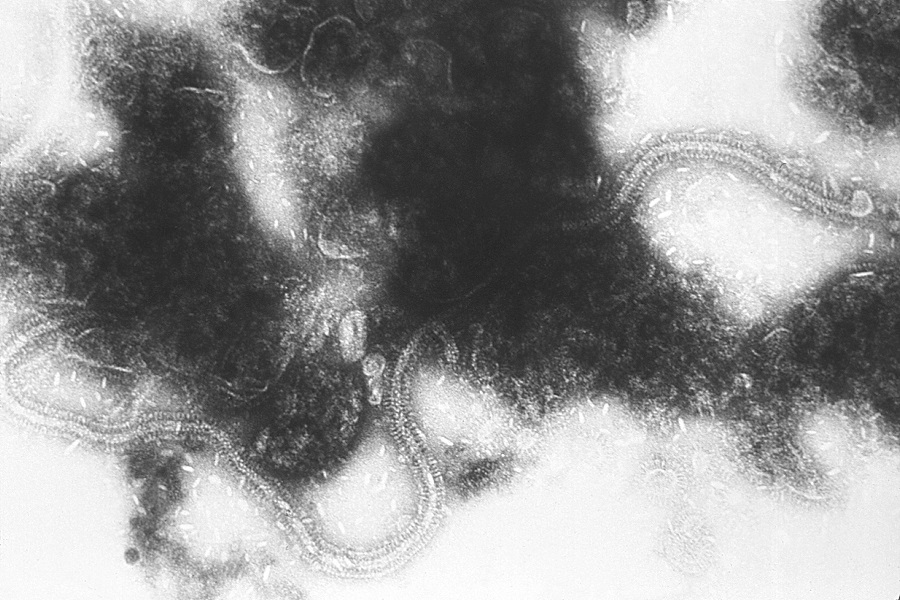 Acute respiratory tract infections: a paradigm shift in diagnosis