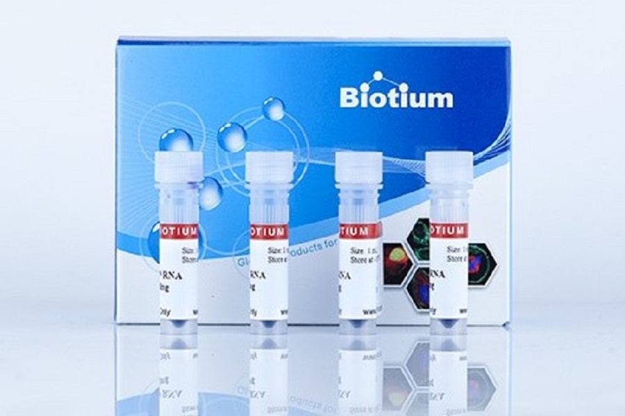 Introducing a super-sensitive RNA prestain loading dye