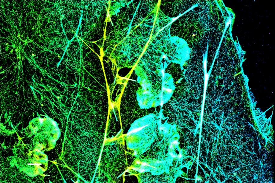 Fluorescent dyes modifications for improved super-resolution imaging 